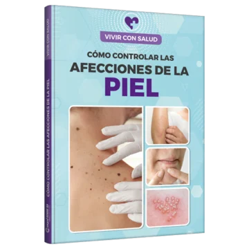 Vivir con salud - Cómo controlar las Afecciones de la piel